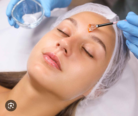 peeling químico 2 sesiones